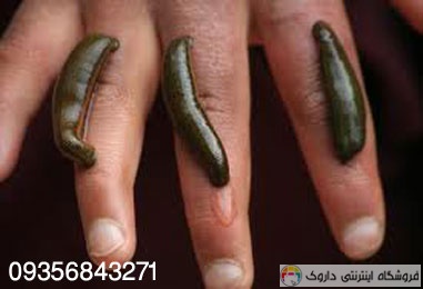 پرورش زالو Breeding leeches