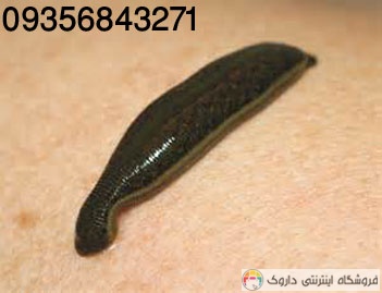 پرورش زالو Breeding leeches