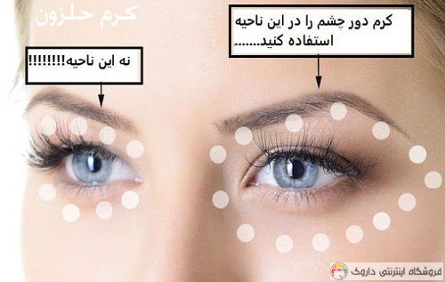 کرم دور چشم و صورت حلزون کرم دور چشم و صورت حلزون